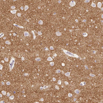 VGLUT1 Antibody in Immunohistochemistry (Paraffin) (IHC (P))