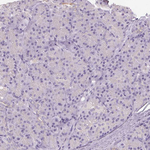 VGLUT1 Antibody in Immunohistochemistry (Paraffin) (IHC (P))