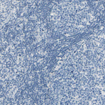 PEBP1 Antibody in Immunohistochemistry (Paraffin) (IHC (P))