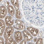 PEBP1 Antibody in Immunohistochemistry (Paraffin) (IHC (P))