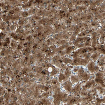 PEBP1 Antibody in Immunohistochemistry (Paraffin) (IHC (P))