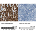 PEBP1 Antibody in Immunohistochemistry (Paraffin) (IHC (P))
