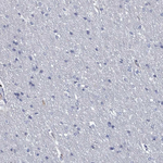 Granzyme A Antibody in Immunohistochemistry (Paraffin) (IHC (P))