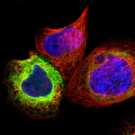SCD Polyclonal Antibody
