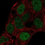 IKZF3 Antibody in Immunocytochemistry (ICC/IF)