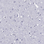 IKZF3 Antibody in Immunohistochemistry (Paraffin) (IHC (P))