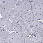 IKZF3 Antibody in Immunohistochemistry (Paraffin) (IHC (P))