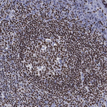 IKZF3 Antibody in Immunohistochemistry (Paraffin) (IHC (P))