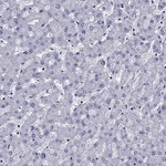 IKZF3 Antibody in Immunohistochemistry (Paraffin) (IHC (P))