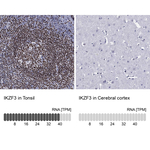 IKZF3 Antibody in Immunohistochemistry (Paraffin) (IHC (P))