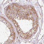 Dynamin 2 Antibody in Immunohistochemistry (Paraffin) (IHC (P))