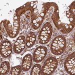 Dynamin 2 Antibody in Immunohistochemistry (Paraffin) (IHC (P))