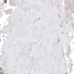 PAR4 Antibody in Immunohistochemistry (Paraffin) (IHC (P))