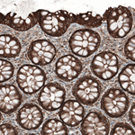 PAR4 Antibody in Immunohistochemistry (Paraffin) (IHC (P))