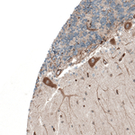PAR4 Antibody in Immunohistochemistry (Paraffin) (IHC (P))
