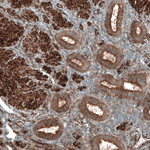 PAR4 Antibody in Immunohistochemistry (Paraffin) (IHC (P))