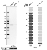 PAR4 Antibody in Western Blot (WB)
