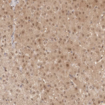 FABP1 Antibody in Immunohistochemistry (Paraffin) (IHC (P))