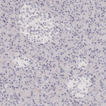 FABP1 Antibody in Immunohistochemistry (Paraffin) (IHC (P))