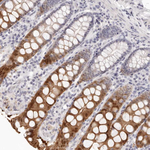 FABP1 Antibody in Immunohistochemistry (Paraffin) (IHC (P))