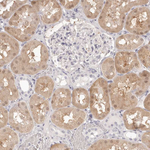 FABP1 Antibody in Immunohistochemistry (Paraffin) (IHC (P))