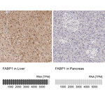 FABP1 Antibody in Immunohistochemistry (Paraffin) (IHC (P))