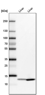 FABP1 Antibody in Western Blot (WB)