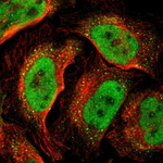 DNMT3B Polyclonal Antibody
