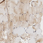 DNMT3B Antibody in Immunohistochemistry (Paraffin) (IHC (P))