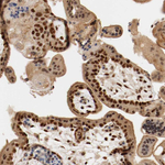 DNMT3B Antibody in Immunohistochemistry (Paraffin) (IHC (P))