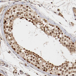 DNMT3B Antibody in Immunohistochemistry (Paraffin) (IHC (P))