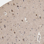 DNMT3B Antibody in Immunohistochemistry (Paraffin) (IHC (P))