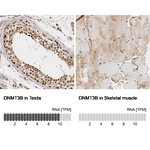 DNMT3B Antibody in Immunohistochemistry (Paraffin) (IHC (P))