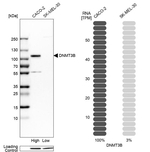 DNMT3B Antibody in Western Blot (WB)