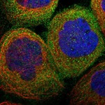 RIP1 Polyclonal Antibody