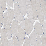 RIP1 Antibody in Immunohistochemistry (Paraffin) (IHC (P))