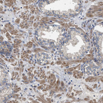 RIP1 Antibody in Immunohistochemistry (Paraffin) (IHC (P))
