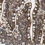 RIP1 Antibody in Immunohistochemistry (Paraffin) (IHC (P))