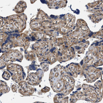 RIP1 Antibody in Immunohistochemistry (Paraffin) (IHC (P))