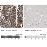 RIP1 Antibody in Immunohistochemistry (Paraffin) (IHC (P))