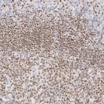 IKZF3 Antibody in Immunohistochemistry (Paraffin) (IHC (P))