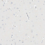 IKZF3 Antibody in Immunohistochemistry (Paraffin) (IHC (P))