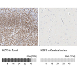 IKZF3 Antibody in Immunohistochemistry (Paraffin) (IHC (P))