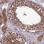 RANBP3 Antibody in Immunohistochemistry (Paraffin) (IHC (P))