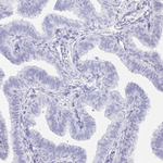 DLK1 Antibody in Immunohistochemistry (Paraffin) (IHC (P))