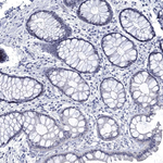 DLK1 Antibody in Immunohistochemistry (Paraffin) (IHC (P))