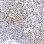 DLK1 Antibody in Immunohistochemistry (Paraffin) (IHC (P))