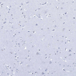 DLK1 Antibody in Immunohistochemistry (Paraffin) (IHC (P))