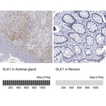 DLK1 Antibody in Immunohistochemistry (Paraffin) (IHC (P))