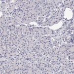 GATA1 Antibody in Immunohistochemistry (Paraffin) (IHC (P))